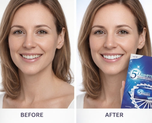 Sorea - 5D Teeth Whitening Strips